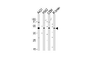 Western blot analysis of lysates from A431, K562, CEM cell line and rat brain tissue lyaste(from left to right), using SUV39H2 Antibody (K315) at 1:1000 at each lane.