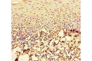Immunohistochemistry of paraffin-embedded human tonsil tissue using ABIN7167196 at dilution of 1:100 (RAC1 抗体  (AA 11-185))