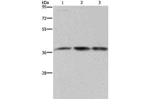 Western Blot analysis of 293T and LoVo cell, Human brain malignant glioma tissue using CAB39 Polyclonal Antibody at dilution of 1:450 (CAB39 抗体)