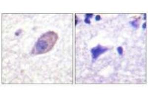 Immunohistochemistry analysis of paraffin-embedded human brain tissue using Kir5. (KIR5.1 抗体)