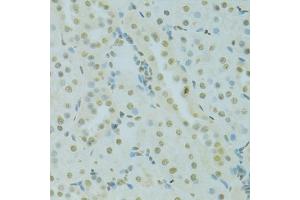 Immunohistochemistry of paraffin-embedded rat kidney using SAFB antibody (ABIN5975793) at dilution of 1/100 (40x lens). (SAFB 抗体)