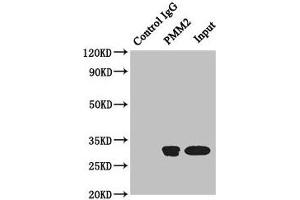 Immunoprecipitating PMM2 in Hela whole cell lysate Lane 1: Rabbit control IgG instead of (1 μg) instead of ABIN7163386 in Hela whole cell lysate.