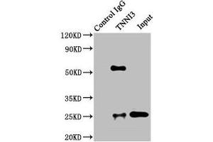 Immunoprecipitating TNNI3 in Rat heart tissue Lane 1: Rabbit control IgG instead of ABIN7173574 in Rat heart tissue. (TNNI3 抗体  (AA 2-210))