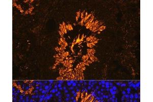 Immunofluorescence analysis of Mouse testis using AKAP4 Polyclonal Antibody at dilution of 1:100. (AKAP4 抗体)