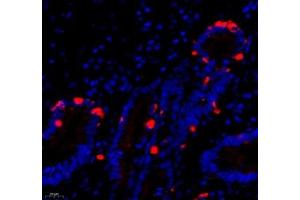 Immunofluorescence (Paraffin-embedded Sections) (IF (p)) image for anti-Tumor Necrosis Factor Receptor Superfamily, Member 6b, Decoy (TNFRSF6B) antibody (ABIN7076071)