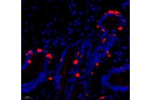 Immunofluorescence of paraffin embedded human gastric cancer using DCR3 (ABIN7076071) at dilution of 1: 700 (400x lens) (TNFRSF6B 抗体)