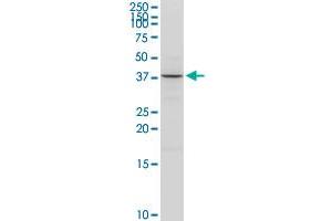 ACAT2 MaxPab rabbit polyclonal antibody. (ACAT2 抗体  (AA 1-397))