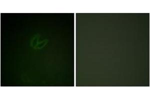 Immunofluorescence analysis of HepG2 cells, using SYK (Phospho-Tyr323) Antibody. (SYK 抗体  (pTyr323))