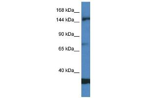 WB Suggested Anti-EIF5B AntibodyTitration: 1. (EIF5B 抗体  (Middle Region))