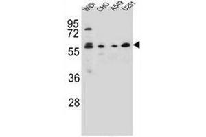 CEP70 Antibody (Center) western blot analysis in WiDr,CHO,A549,U251 cell line lysates (35µg/lane). (CEP70 抗体  (Middle Region))