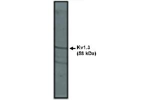 Western Blotting (WB) image for anti-Potassium Voltage-Gated Channel, Shaker-Related Subfamily, Member 3 (KCNA3) antibody (ABIN306871)