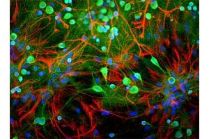 Rat mixed neuron/glial cultures stained with anti-UCHL1 antibody (green) and rabbit anti-GFAP antibody (620-GFAP) (red). (UCHL1 抗体)