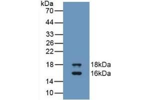 Detection of Recombinant GDF3, Human using Monoclonal Antibody to Growth Differentiation Factor 3 (GDF3) (GDF3 抗体  (AA 251-364))