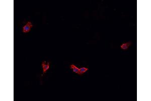 ABIN6269331 staining HeLa cells by IF/ICC. (Caldesmon 抗体  (C-Term))