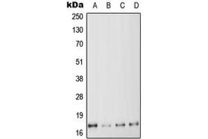 Western blot analysis of MYL6 expression in HeLa (A), K562 (B), SP2/0 (C), H9C2 (D) whole cell lysates. (MYL6 抗体  (Center))
