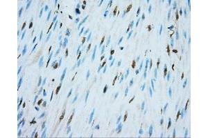Immunohistochemical staining of paraffin-embedded colon tissue using anti-NIT2 mouse monoclonal antibody. (NIT2 抗体)