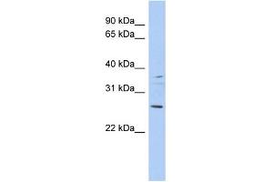 WB Suggested Anti-ASCL2 Antibody Titration:  0.