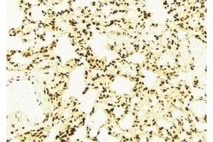 ABIN6278854 at 1/100 staining Mouse lung tissue by IHC-P. (DNAJA1 抗体  (C-Term))