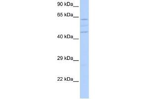 VPS37A antibody used at 1 ug/ml to detect target protein.