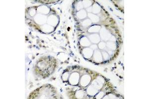Immunohistochemistry (IHC) image for anti-Cell Division Cycle 27 Homolog (S. Cerevisiae) (CDC27) (AA 551-830) antibody (ABIN1679113)