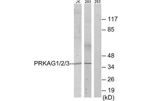 Western blot analysis of extracts from Jurkat cells and 293 cells, using PRKAG1/2/3 antibody. (PRKAG1/2/3 抗体  (Internal Region))