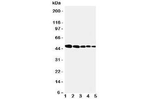 Western blot testing of Flotillin 1 antbody; Lane 1: rat lung;  2: (r) brain;  3: (r) ovary;  4: human SMMC-7721;  5: (h) MFC-7 cell lysate. (Flotillin 1 抗体  (Middle Region))
