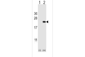 Western Blotting (WB) image for anti-Cofilin 1 (CFL1) (AA 70-98) antibody (ABIN650759)