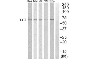 Western Blotting (WB) image for anti-Follistatin (FST) (Internal Region) antibody (ABIN1852807) (Follistatin 抗体  (Internal Region))