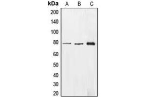 Western blot analysis of EHHADH expression in HepG2 (A), HEK293T (B), A549 (C) whole cell lysates. (EHHADH 抗体  (Center))