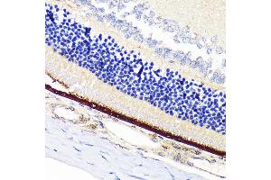 Immunohistochemistry of paraffin-embedded rat retina using RPE65 Rabbit mAb (ABIN7269933) at dilution of 1:100 (40x lens). (RPE65 抗体)