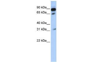 Western Blotting (WB) image for anti-ATP-Binding Cassette, Sub-Family D (Ald), Member 4 (ABCD4) antibody (ABIN2458768) (ABCD4 抗体)