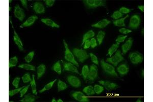 Immunofluorescence of monoclonal antibody to RPL13 on HeLa cell. (RPL13 抗体  (AA 112-211))
