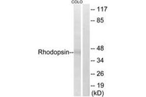 Western blot analysis of extracts from COLO cells, using Rhodopsin (Ab-334) Antibody. (Rhodopsin 抗体  (AA 299-348))
