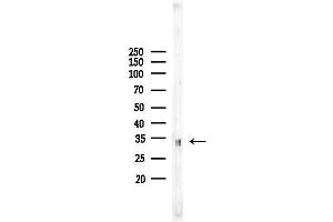 anti-TNFRSF1A-Associated Via Death Domain (TRADD) antibody