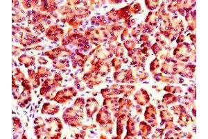 Immunohistochemistry of paraffin-embedded human pancreatic tissue using ABIN7161824 at dilution of 1:100 (NUP85 抗体  (AA 201-500))