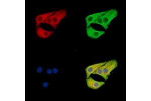 ABIN7096515 and ABIN7100579 staining Hela cells by IF/ICC. (SLC12A6 抗体)