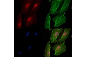 Phospho-SIRT2 (Ser368) Antibody staining A549 cells(heat shock treatment) by IF/ICC.