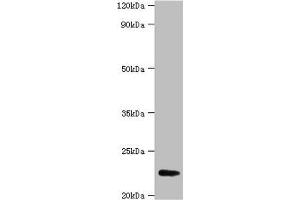 Western blot All lanes: FGF21 antibody at 2 μg/mL + A549 whole cell lysate Secondary Goat polyclonal to rabbit IgG at 1/15000 dilution Predicted band size: 23 kDa Observed band size: 23 kDa (FGF21 抗体  (AA 29-209))