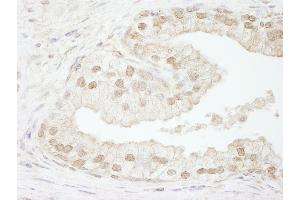 Immunohistochemistry (IHC) image for anti-Chromatin Assembly Factor 1, Subunit B (p60) (CHAF1B) (C-Term) antibody (ABIN7448454) (CHAF1B 抗体  (C-Term))