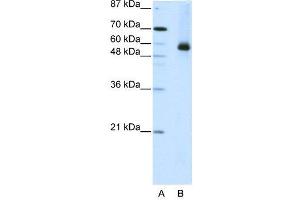 WB Suggested Anti-HNRPL  Antibody Titration: 2. (HNRNPL 抗体  (N-Term))