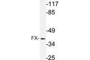 Western blot (WB) analysis of FX antibody in extracts from rat muscle cells. (TSTA3 抗体)