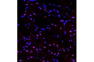 Immunofluorescence of paraffin embedded mouse heart using RNF7 (ABIN7075471) at dilution of 1:2000 (400x lens) (RNF7 抗体)