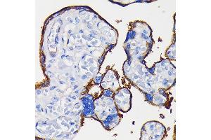 Immunohistochemistry of paraffin-embedded human placenta using Integrin alpha 5 (ITG/CD49e) (ITG/CD49e) Rabbit mAb (ABIN7267936) at dilution of 1:100 (40x lens). (ITGA5 抗体)