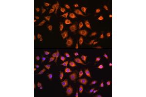 Immunofluorescence analysis of L929 cells using COPZ1 antibody (ABIN6127709, ABIN6138892, ABIN6138893 and ABIN6215734) at dilution of 1:100. (COPZ1 抗体  (AA 1-177))