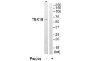 Western blot analysis of extracts from Jurkat cells, using TBX18 antibody. (T-Box 18 抗体)