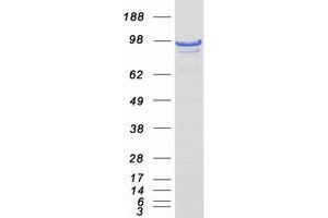 Validation with Western Blot