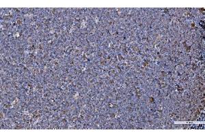 IHC analysis of GRP94 using anti-GRP94 antibody (ABIN3042463).