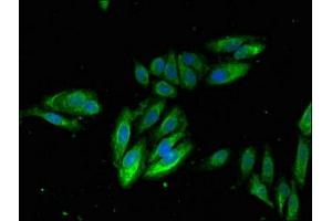 Immunofluorescent analysis of Hela cells using ABIN7156481 at dilution of 1:100 and Alexa Fluor 488-congugated AffiniPure Goat Anti-Rabbit IgG(H+L) (Integrin beta 2 抗体  (AA 37-201))
