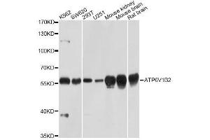 Western blot analysis of extracts of various cell lines, using ATP6V1B2 Antibody. (ATP6V1B2 抗体  (AA 262-511))