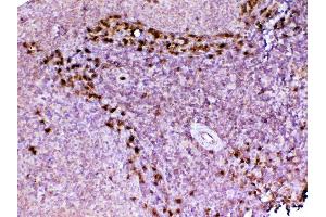 IHC analysis of ADA using anti-ADA antibody .